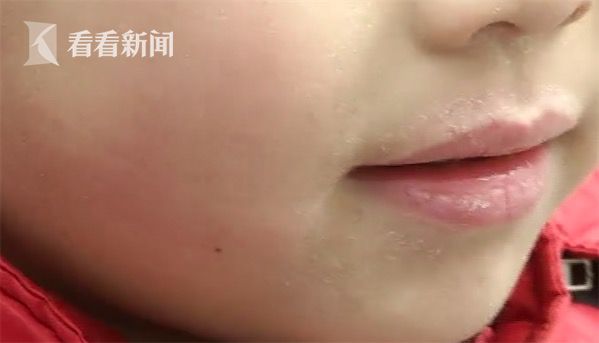 巣ѧԼʢ ҳΪ߲