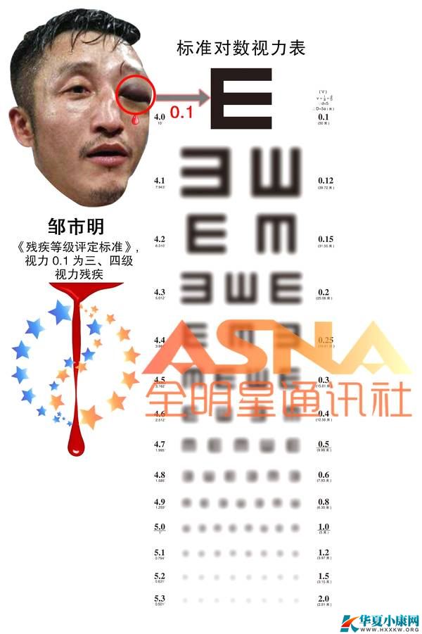 \