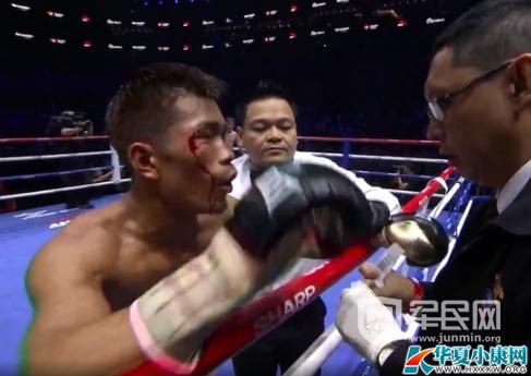 ���������ƴ��˱��� ȽӨӱ����������������Ļ