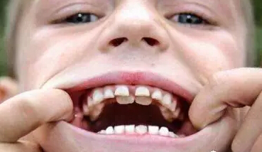 \