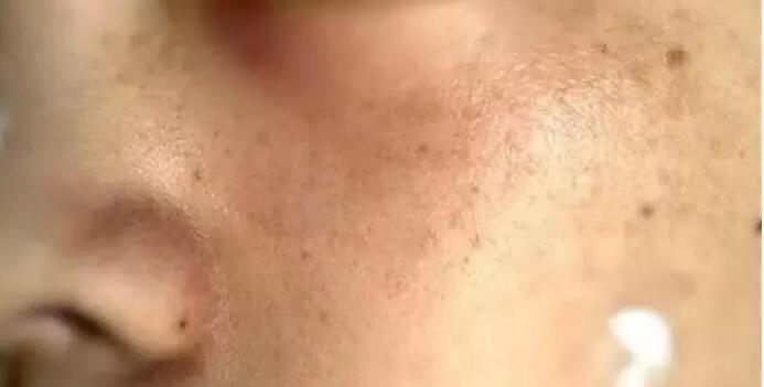 \