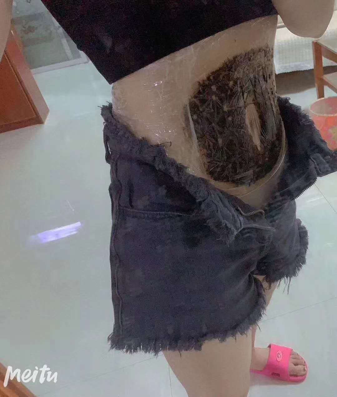 \